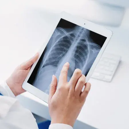 a doctor looking at an x-ray on a tablet