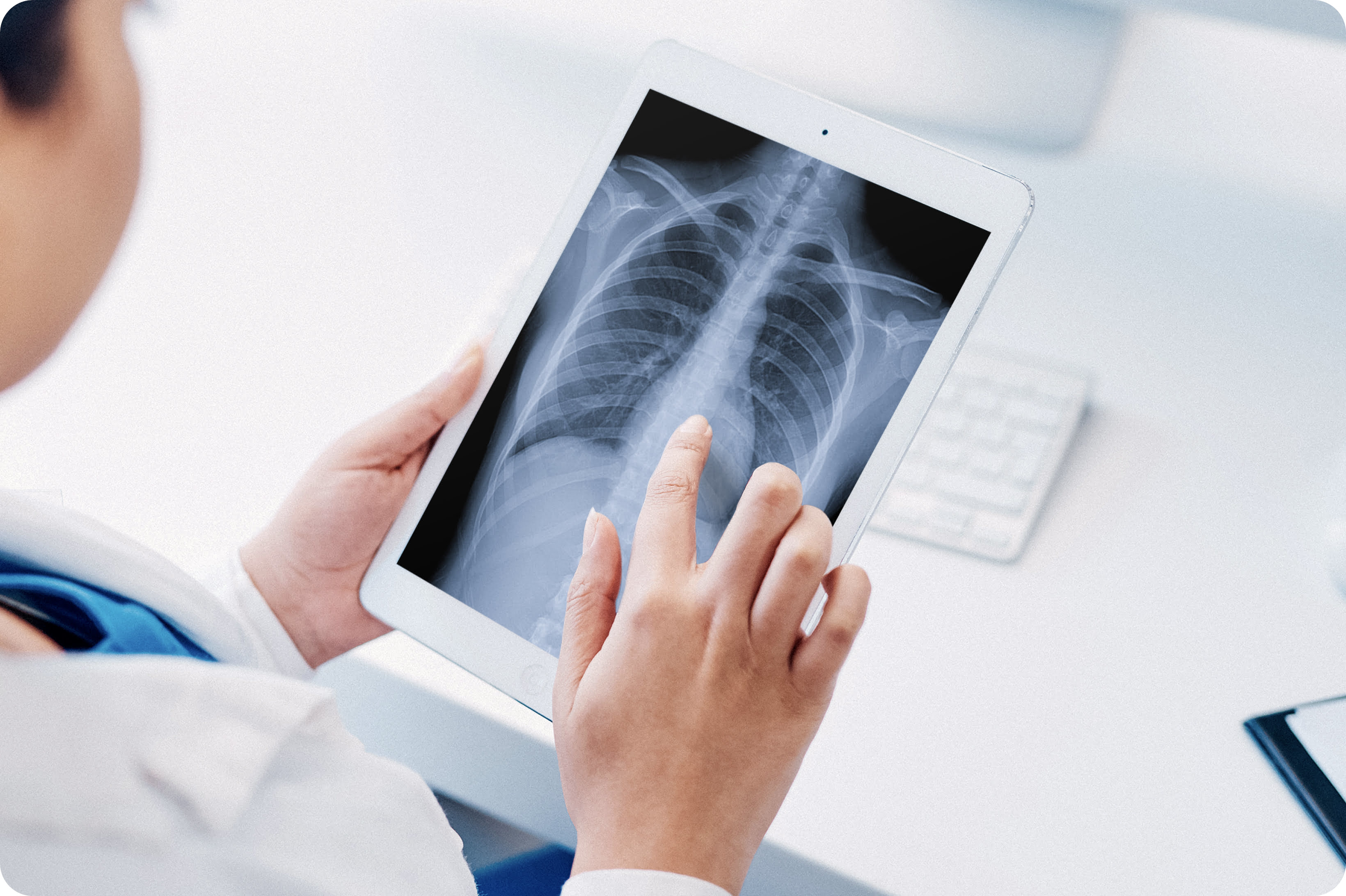 A doctor looking at an x-ray on a tablet